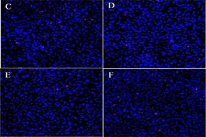 Determining the involvement of microRNAs in gene regulation and cellular injury response in vascular smooth muscle cells