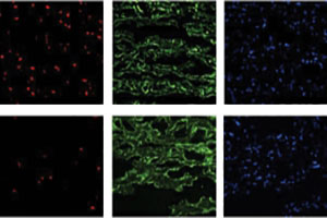 Identify the roles of ischaemic preconditioning-regulated miRNAs in cardiac protection