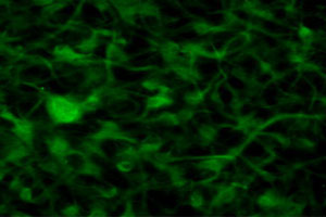 miRNA-125b up-regulation contributes to astrogliosis and to defects in the cell cycle that are characteristic of degenerating brain tissues