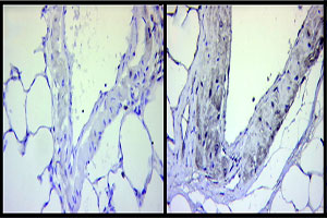 Understand how dynamic changes in lung microRNA profiles affect the development of pulmonary hypertension