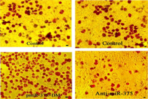 Investigating the role of miRNAs in adipocyte differentiation