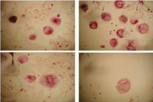 Develop a new therapeutic method for osteoporosis through insight into osteoclastogenesis