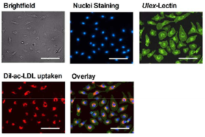 Reveal a novel mechanistic basis for tissue repair in diabetic wound treatments