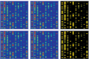 miRNAs represent novel biomarkers for neuronal malfunction and potential therapeutic targets for human neurodegenerative diseases