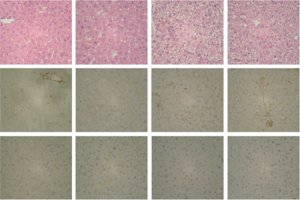 Revealing novel molecular determinants in the pathogenesis of diet-induced nonalcoholic fatty liver disease