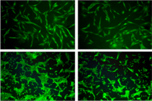 Identifying a functional role of miRNAs in nonalcoholic fibrosing steatohepatitis