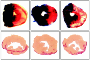 Demonstrate that therapeutic dosing of miR-15 family inhibitor protects against ischemic injury to the heart