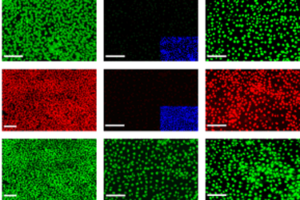 Derive clinically relevant neural lineages from hESCs for regenerative therapies