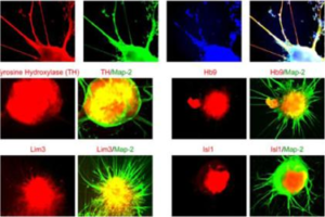 Develop effective cell-based therapies against a wide range of neurological disorders