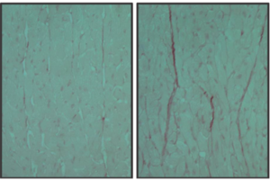 Uncovering factors that mediate LPS-induced cardiac fibrosis