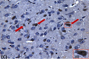 Investigating the role of miRNAs in the etiology of Parkinson’s disease