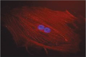 Show that targeting specific miRNAs reduces overt abnormalities in smooth muscle differentiation after vascular injury