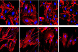 Identify a small molecule drug for diagnosis and treatment of pulmonary arterial hypertension