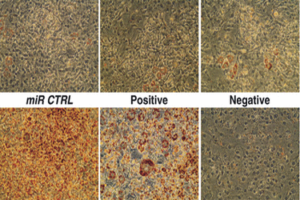 Discovering a a new class of adipogenic inhibitors that play a role in the pathological development of obesity