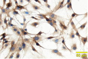 Identify an alternative therapeutic target for treatment of neurological disorders in peadiatric prolonged anesthesia or sedation