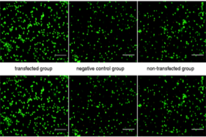 miR-9-1 may act as a potential biomarker for the diagnosis and monitoring of changes in methylmalonic acidemia (MMA)