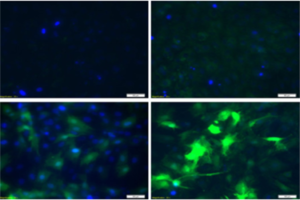 Novel insights about the molecular mechanisms of deregulated miRNA expression during the heart disease pathogenesis